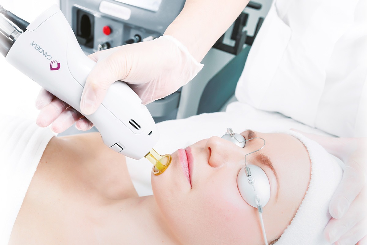 開業機器サポート | シネロン・キャンデラ Syneron Candela